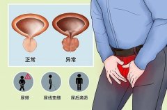 前列腺炎会导致性功能下