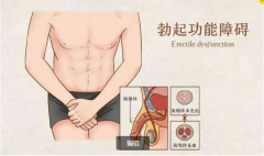男人出现勃起功能障碍是什么原因