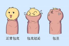 包皮有红斑边上有白圈是咋回事