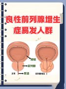 总是想尿、尿完仍有尿意还疼,到底是怎么回事?